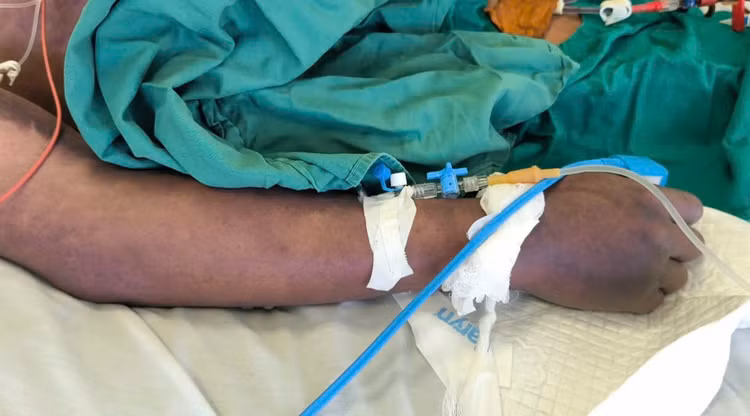 Bệnh nhân nhập viện trong tình trạng sốc nhiễm khuẩn, xuất hiện ban xuất huyết hoại tử lan rộng toàn thân, đặc biệt ở vùng mặt và tứ chi - Ảnh BVCC