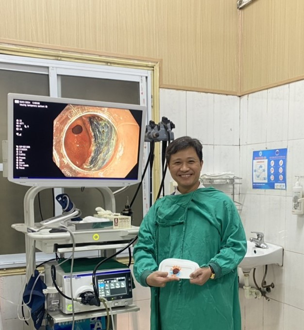 Bệnh phẩm tách niêm mạc dạ dày thực hiện tại Bệnh viện Trung ương Thái Nguyên