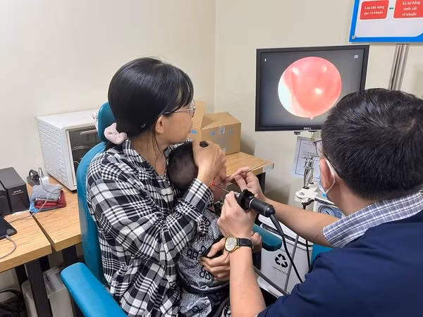 Các bác sĩ nội soi lấy dị vật cây gỗ cho trẻ - Ảnh BVCC