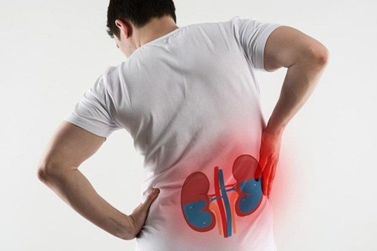 Đau lưng là một trong những dấu hiệu thận ứ nước - Ảnh minh họa