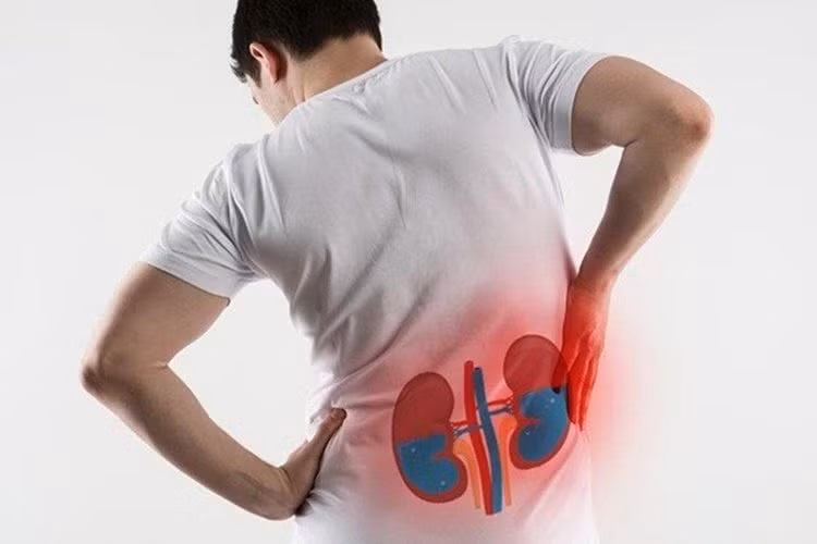 Đau lưng là một trong những dấu hiệu thận ứ nước - Ảnh minh họa