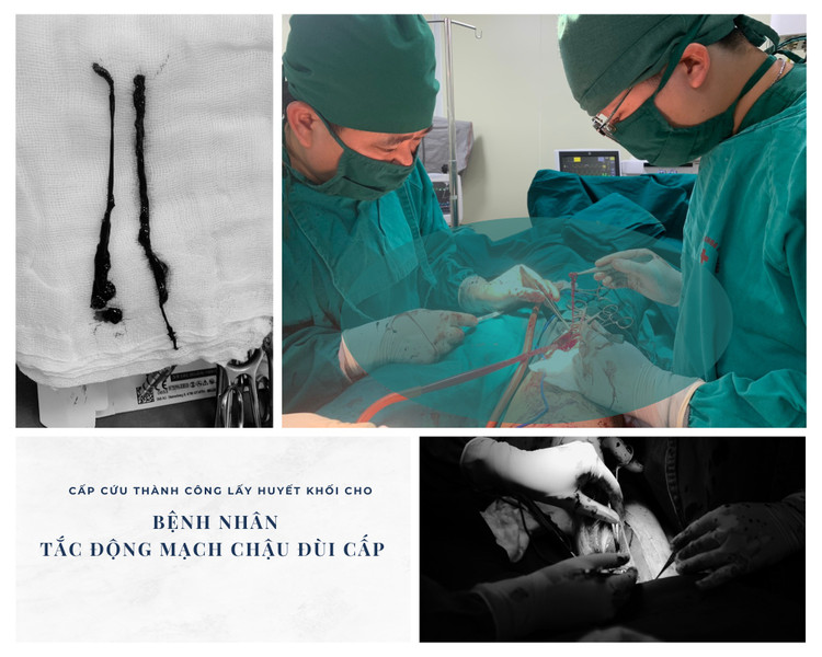 Các bác sĩ phẫu thuật cho bệnh nhân - Ảnh BVCC