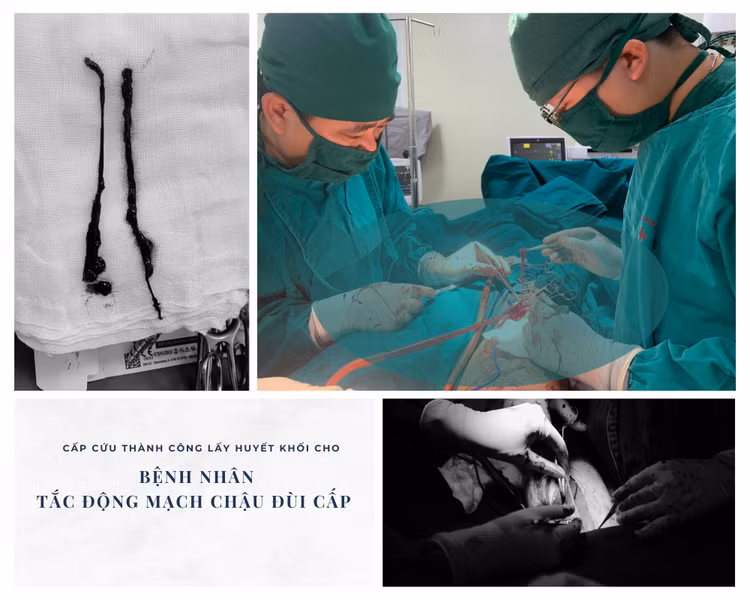 Các bác sĩ phẫu thuật cho bệnh nhân - Ảnh BVCC