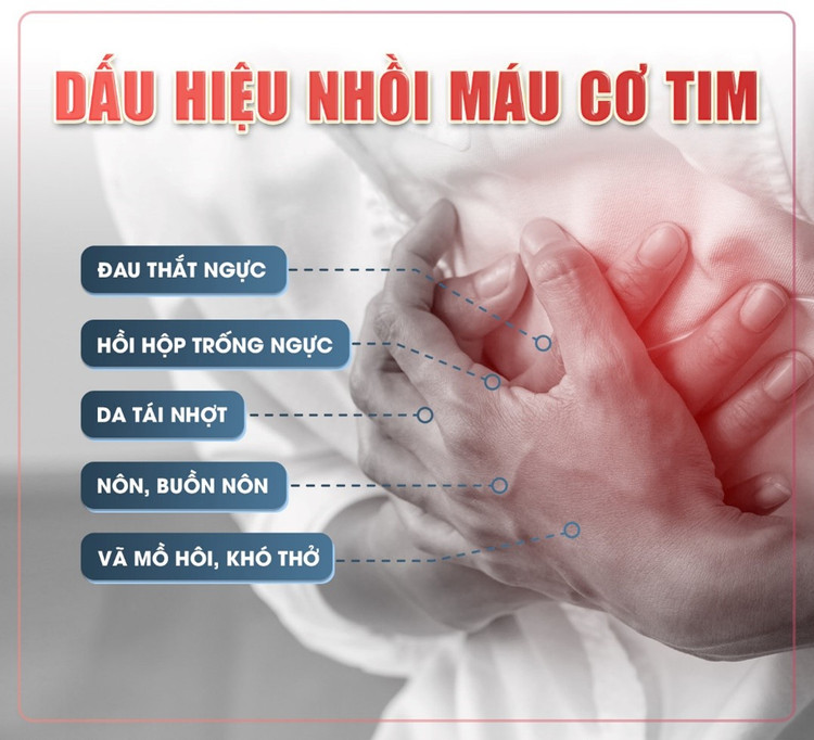 Dấu hiệu nhồi máu cơ tim cấp - Ảnh minh họa BVCC