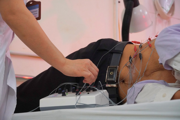 Điều trị đau dây thần kinh do zona - Ảnh BVCC Điều trị đau dây thần kinh do zona - Ảnh BVCC