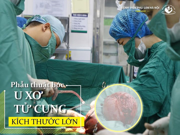 Ca phẫu thuật cắt khối u khủng gây xơ hóa cho bệnh nhân - Ảnh BVCC