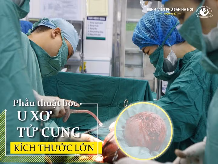 Ca phẫu thuật cắt khối u khủng gây xơ hóa cho bệnh nhân - Ảnh BVCC