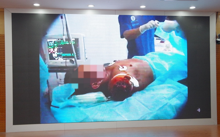 Bệnh nhân bị cá kéo đứt cánh tay + chấn thương nghiêm trọng - Ảnh BVCC