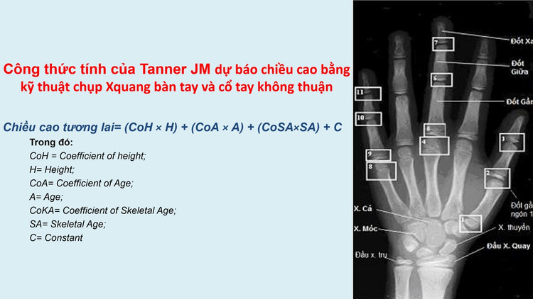 Một phương pháp dự báo chiều cao (Phương pháp Tanner JM) Một phương pháp dự báo chiều cao (Phương pháp Tanner JM)