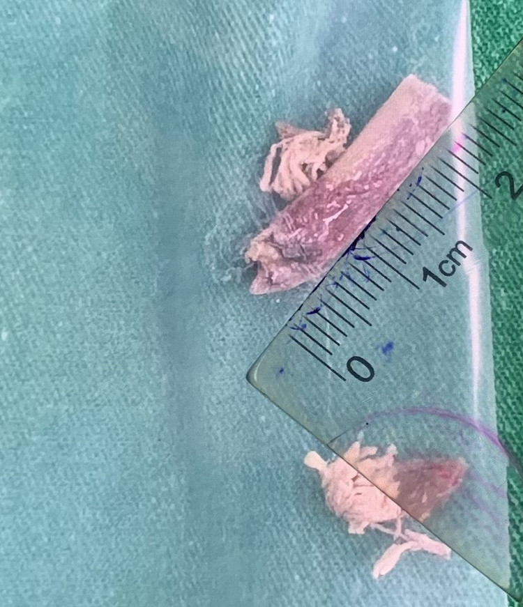 Xương gà đã được lấy ra Xương gà đã được lấy ra