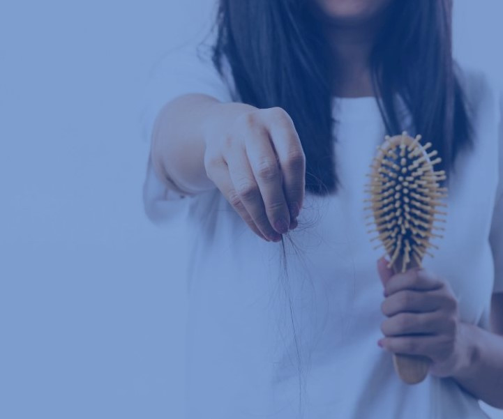 Vì sao người trẻ tuổi lại bị rụng tóc nhiều? ảnh 1