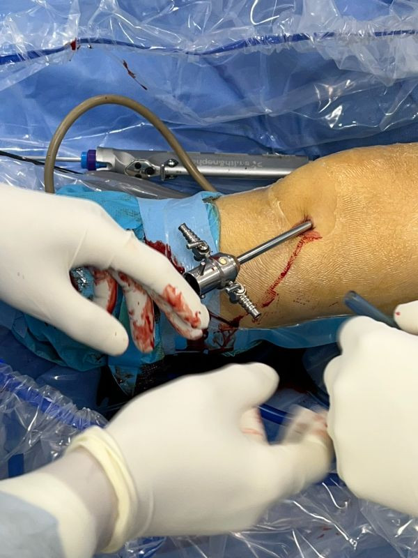 Phẫu thuật nội soi cho bệnh nhân