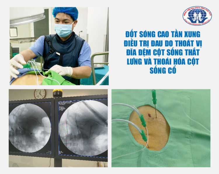 TS.BS Vi Trường Sơn – Trưởng khoa Ngoại yêu cầu điều trị đau bằng phương pháp Đốt sóng cao tần xung cho 2 mẹ con người bệnh -Ảnh BVCC