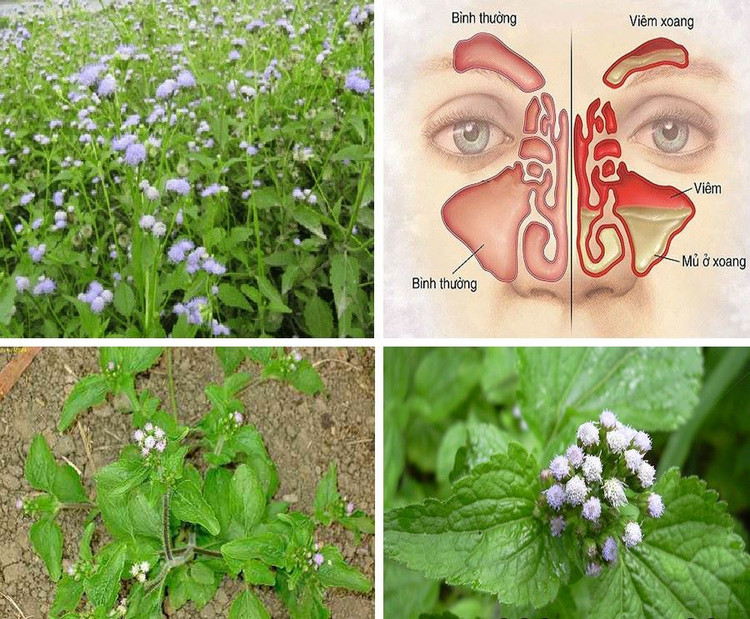 Cây cứt lợn thường được điều trị viêm xoang - Ảnh minh họa