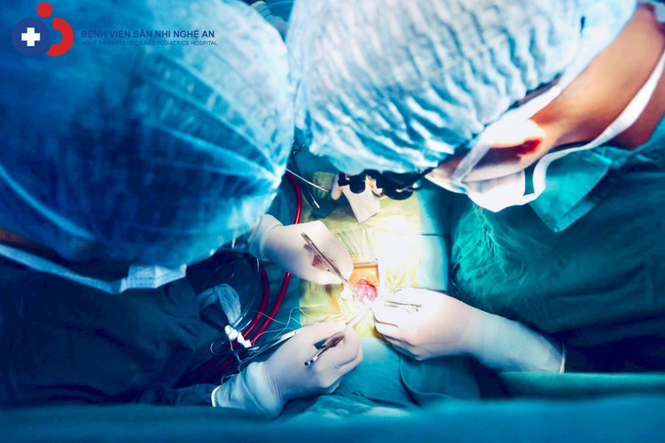 Ca phẫu thuật cho bé - Ảnh BVCC