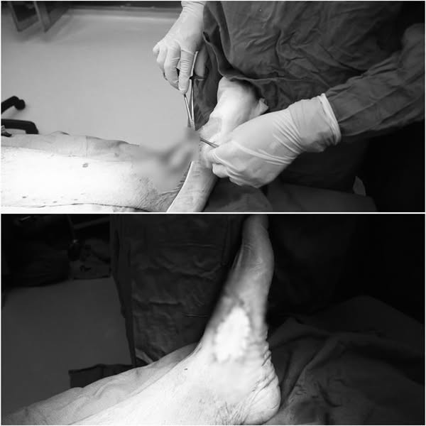 Xử lý vết thương cho bệnh nhân - Ảnh BVCC