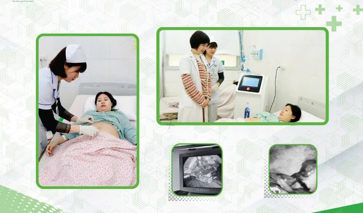 Khối u buồng xoắn được cắt bỏ - Ảnh BVCC