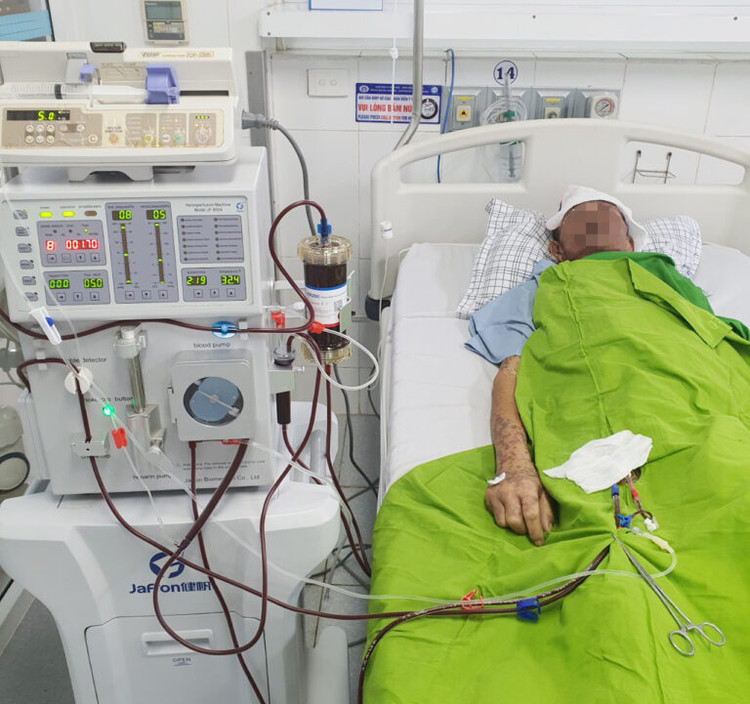 Bệnh nhân phải lọc máu vì dị ứng thuốc - Ảnh BVCC