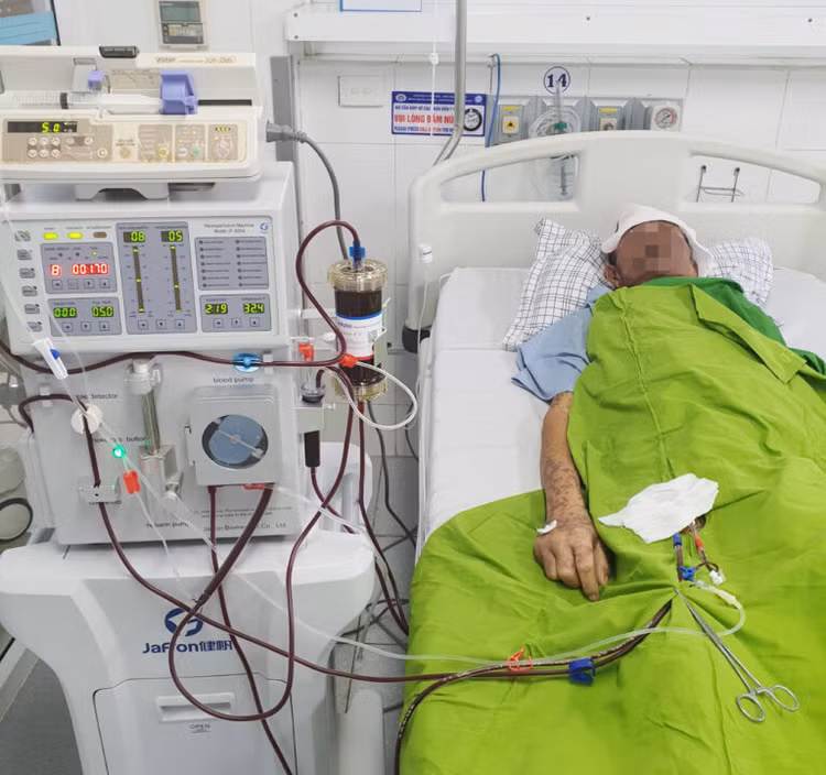 Bệnh nhân phải lọc máu vì dị ứng thuốc - Ảnh BVCC
