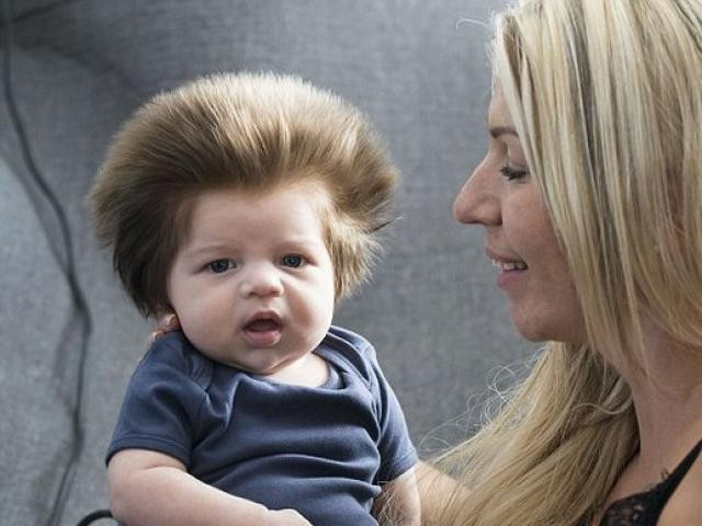 Tóc dựng đứng - Ảnh minh họa