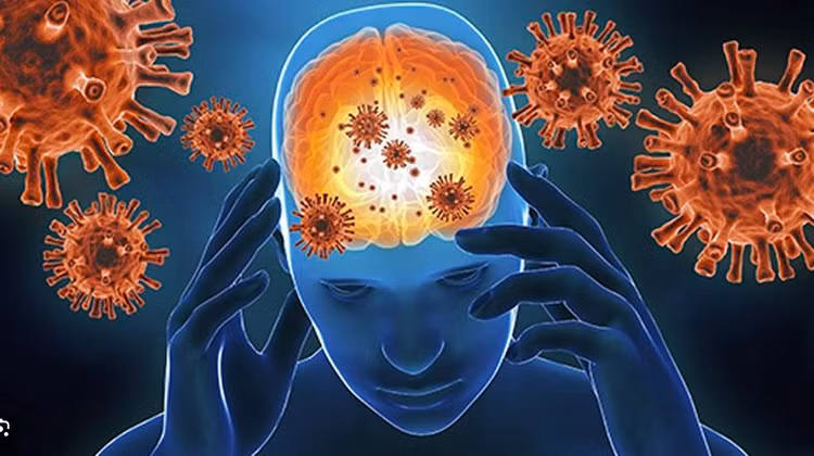 Tưởng đột quỵ nào ngờ viêm não tự miễn thể hiếm gặp