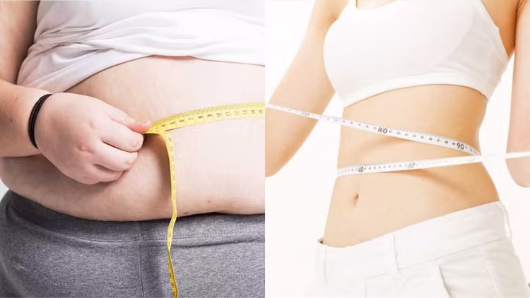 Vòng eo quá nhiều mỡ sẽ làm tăng nguy cơ mắc bệnh tiểu đường, cao huyết áp, mỡ máu cao - Ảnh Minh họa