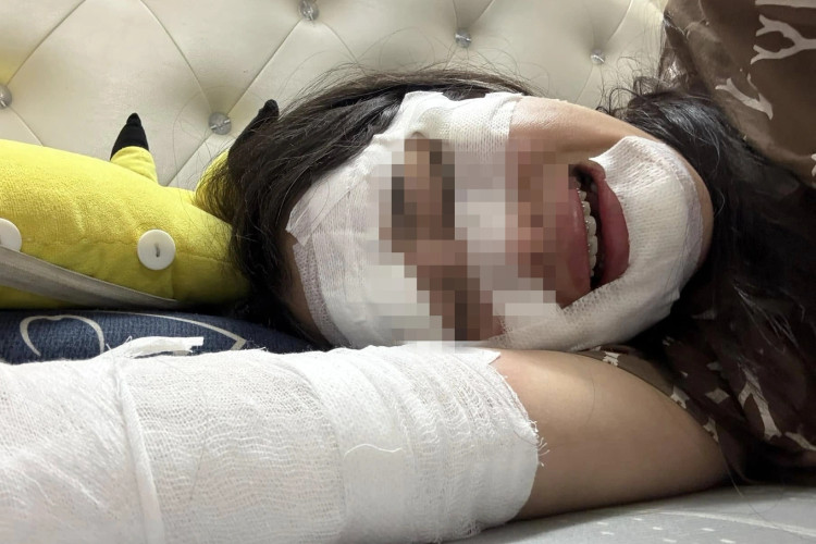 Vụ tai nạn là lời cảnh báo về sử dụng bóng bay - Ảnh minh họa Internet