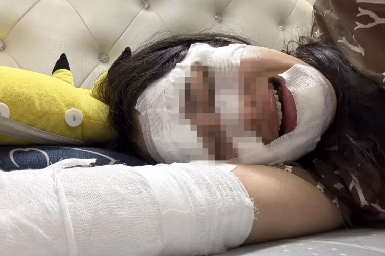 Vụ tai nạn là lời cảnh báo về sử dụng bóng bay - Ảnh minh họa Internet Vụ tai nạn là lời cảnh báo về sử dụng bóng bay - Ảnh minh họa Internet