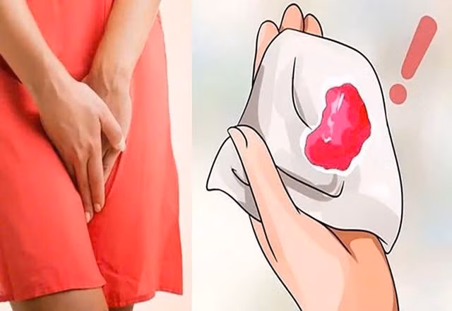 Xuất huyết âm đạo sau mãn kinh là dấu hiệu cảnh báo quan trọng của ung thư nội mạc tử cung - Ảnh minh họa