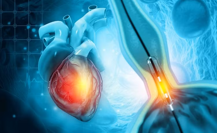 Chụp mạch vành qua đường ống thông có gây nguy hiểm? - Ảnh minh họa/ Internet