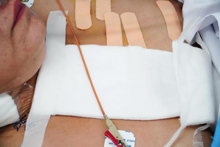 Kích hoạt báo động đỏ cứu người phụ nữ bị đâm 17 nhát ảnh 1