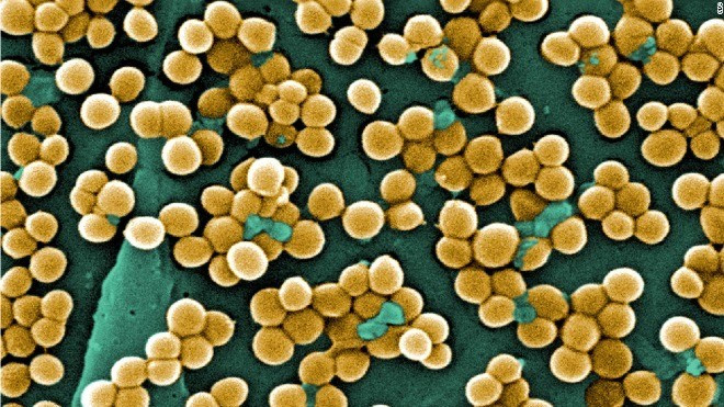 Vi khuẩn tụ cầu vàng có thể sống ký sinh trên da và niêm mạc