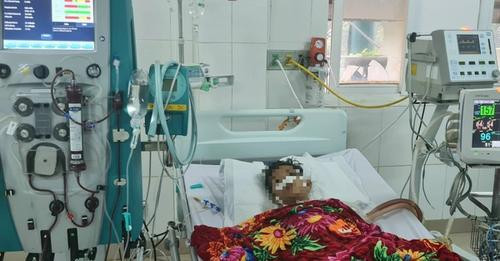 Lọc máu, thay huyết tương cứu sống bé 12 tuổi nguy kịch do tụ cầu vàng ảnh 1