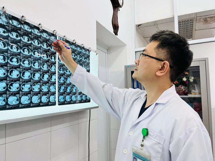 Cắt khối u giáp khổng lồ nằm sâu trong lồng ngực cụ bà 86 tuổi ảnh 1