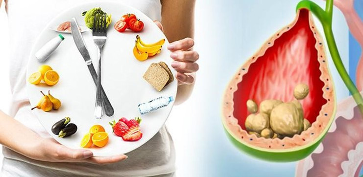 Cách ăn uống giúp tan sỏi mật ảnh 1