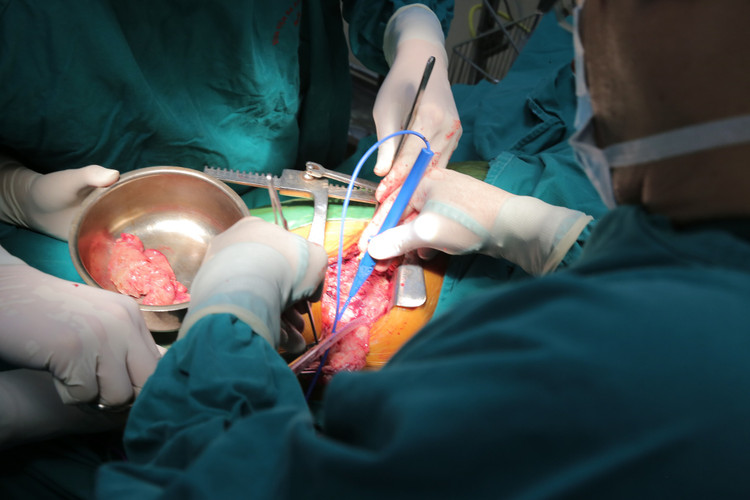 Phẫu thuật lấy khối u phổi “khủng” nặng 3kg ảnh 2