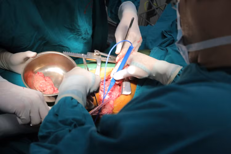 Phẫu thuật lấy khối u phổi “khủng” nặng 3kg ảnh 2