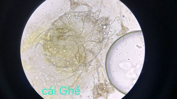 Cái ghẻ qua kính hiển vi - Ảnh BVCC