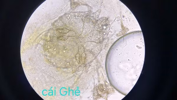 Cái ghẻ qua kính hiển vi - Ảnh BVCC