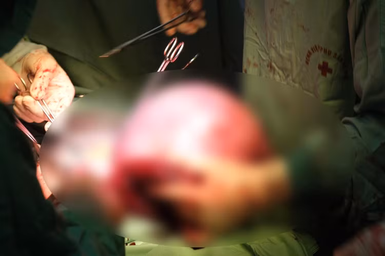 Ca phẫu thuật cấp cứu cho sản phụ - Ảnh BVCC