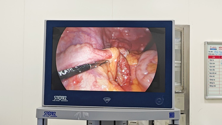 Phẫu thuật nội soi cho bệnh nhân - Ảnh BVCC