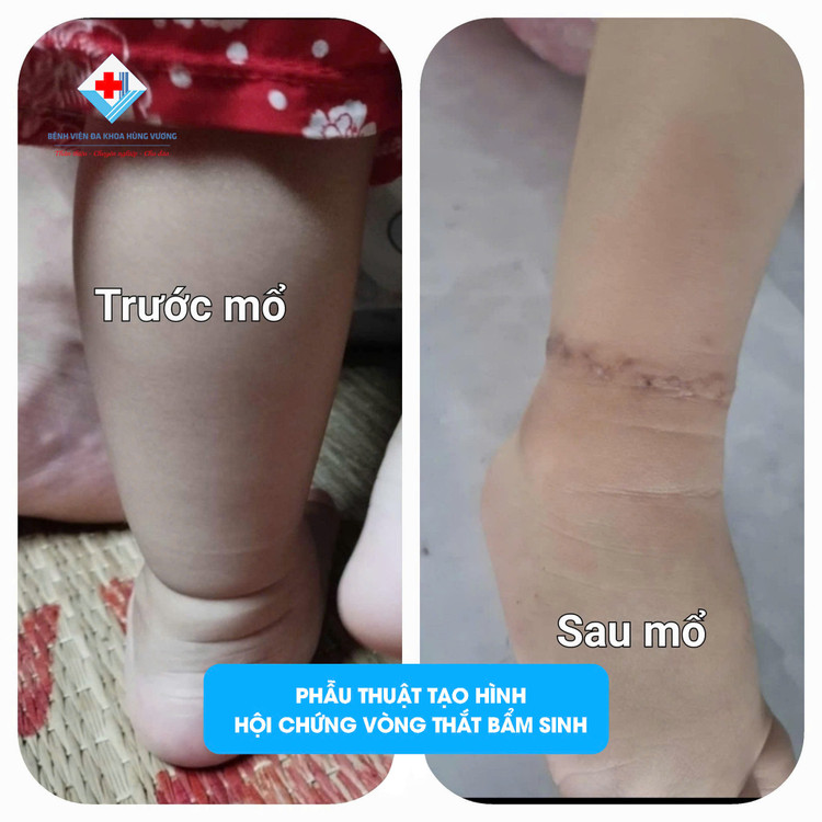 Ảnh BVCC Ảnh BVCC