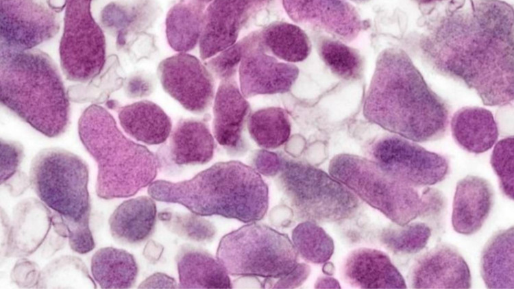 Vi khuẩn Mycoplasma gây ho ra máu tại Nga - Ảnh minh họa