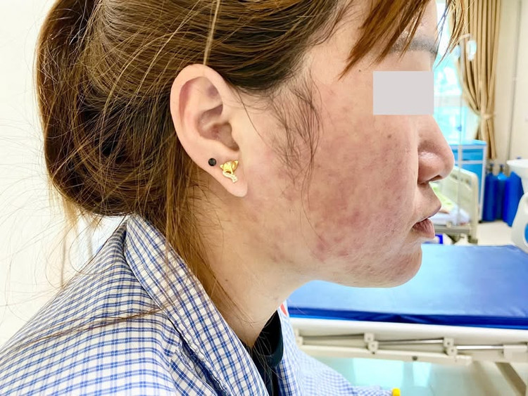 Tự mua thuốc uống, cô gái bị sốc phản vệ - Ảnh minh họa