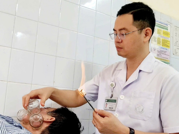 Điều trị liệt dây thần kinh số VII ngoại biên bằng giác hơi