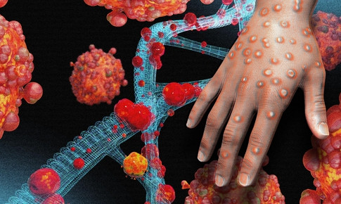 Xuất hiện ca đậu mùa khỉ chưa xác định được nguồn lây, cần biết 6 khuyến cáo phòng chống dịch của Bộ Y tế -