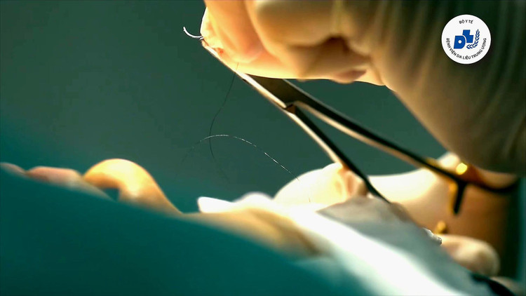 Hiện các bác sĩ Bệnh viện Da liễu TƯ sử dụng một số kỹ thuật của Hàn Quốc