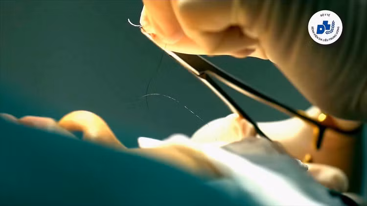 Hiện các bác sĩ Bệnh viện Da liễu TƯ sử dụng một số kỹ thuật của Hàn Quốc