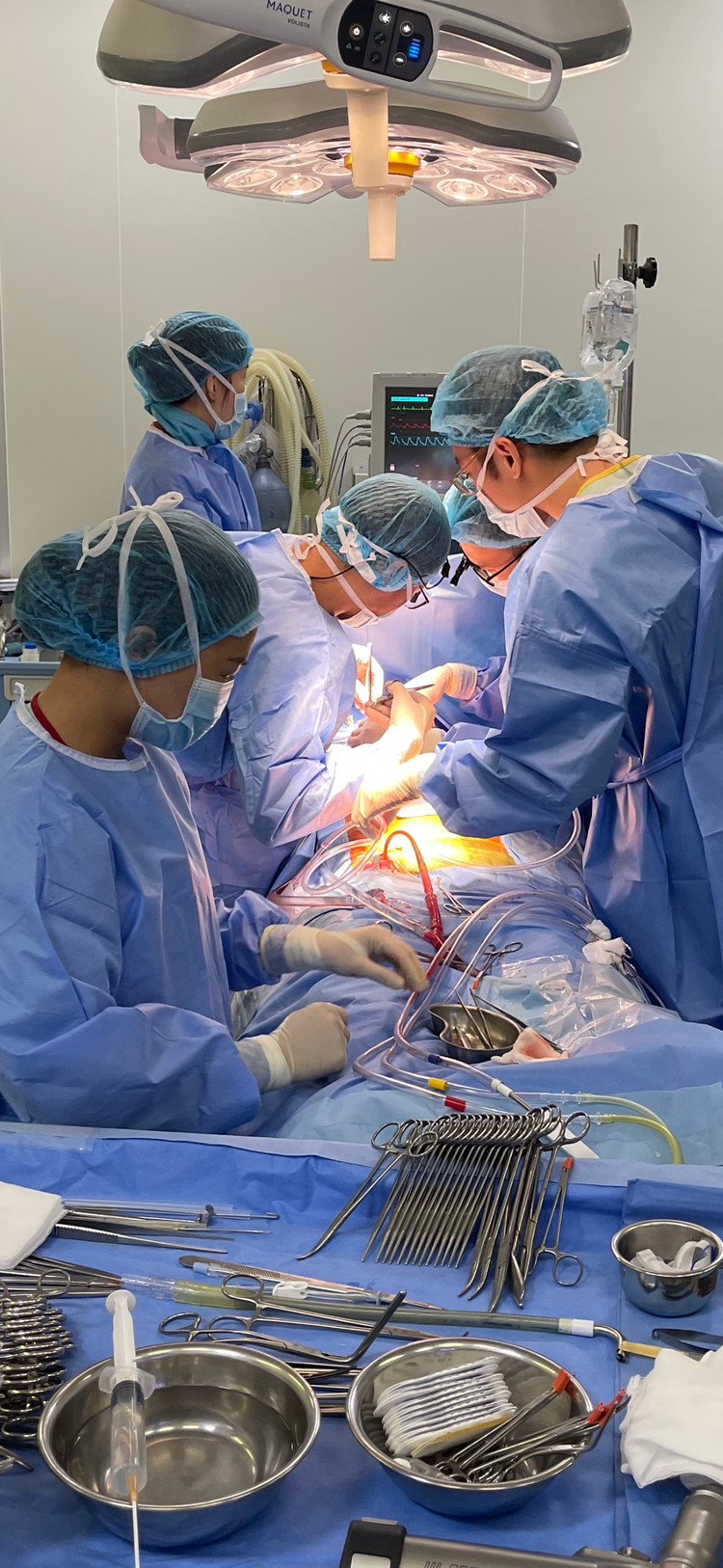 Phẫu thuật cho bệnh nhân lóc tách động mạch chủ tại Bệnh viện E