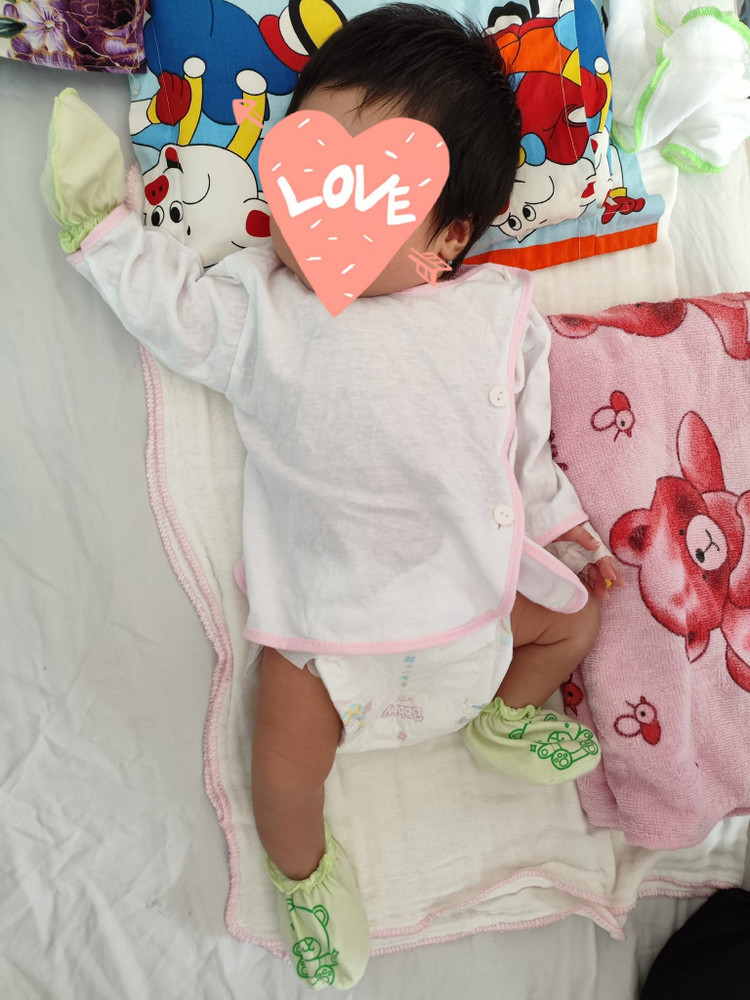 Trẻ vàng da nhiễm trùng nặng do bất đồng nhóm máu mẹ con